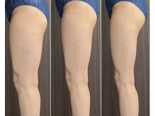 太い脚、解決法