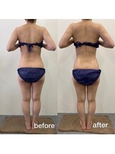 リラクラージュ(Ri Ra Courage)/40代１回施術後