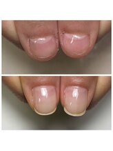 リヒネイル(Rihi.nail)/自爪育成