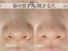 テンニック(10nick)