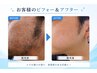 【ヒゲ・両ワキ・両腕・脚などに】セルフ脱毛 15分コース ¥3,300→¥2,750