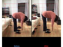 ボディクラフト/【施術例】前屈時の痛み