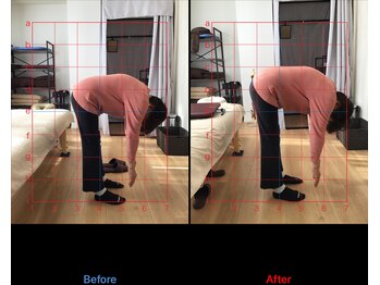 ボディクラフト/【施術例】前屈時の痛み