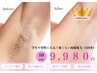 【学生や男性に人気・お得な脇脱毛5回券】多汗/脇汗/脇ジミ/ニオイ解消