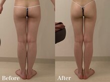 ラヴィエ ベル(La vie est belle)/当サロン人気の下半身コース