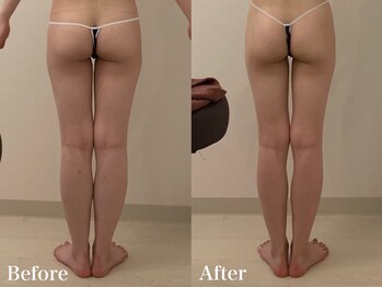 ラヴィエ ベル(La vie est belle)/当サロン人気の下半身コース