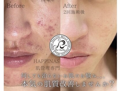 ハピナス(HAPPINAS)の写真