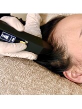 ルポアミ 代々木上原(REPOS AMI)/プラズマ頭皮で増毛&髪質改善