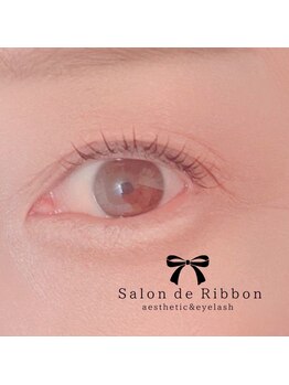 サロン ド リボン(Salon de Ribbon)/*施術イメージ*