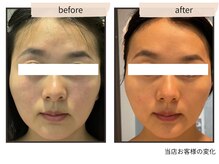 コンビンス(convince)/小顔とエイジングケア