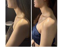 アミナス(Total Beauty Salon AMINAS)/華奢みえコルギ