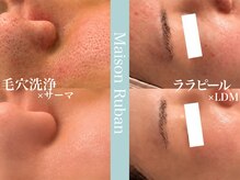 メゾンリュバン 梅田店(Maison Ruban)の雰囲気（毛穴改善プログラム［ピーリング/毛穴/毛穴洗浄/黒ずみ毛穴］）