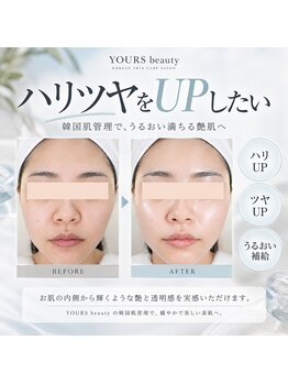 ユアーズ ビューティー(YOURS beauty)の写真/11種類の国産ハーブピーリングで毛穴ケア！理想のハリ艶あふれる素肌へ整える☆