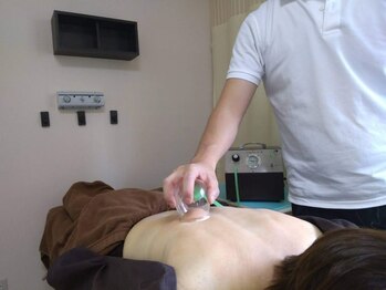 泉町鍼灸整骨院/スライドカッピング