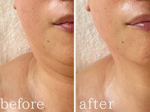 フォー(For...)/リンパマッサージ◇天王寺