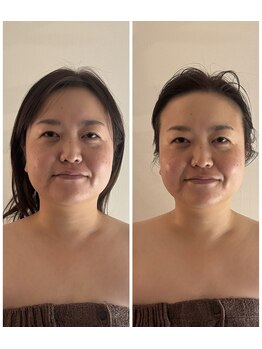 スワフルール(soi Fleur)/黄金比小顔全身コルギ