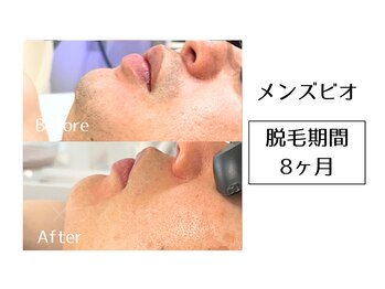 メンズビオ 神戸三宮店/