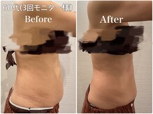 ルクール(Lecoeur)の雰囲気（痛みの少ない痩身エステ！リラックスしている間にサイズダウン！）