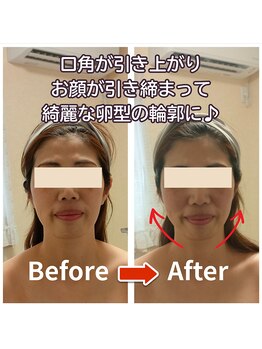 ラヴィフルリル(Ravi FleuRir)/小顔矯正ヘッドスパの変化