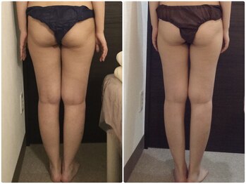 美容整体 ウェリナ 蟹江院/小顔矯正/骨盤矯正/美脚サロン