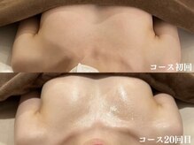 ジョリー(Jolie)/