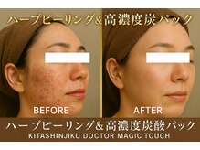 ドクターマジックタッチ(Dr.MAGIC TOUCH)の雰囲気（ブルドック顔・ほうれい線・二重アゴ付き過ぎた脂肪に脂肪分解）