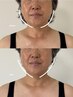 【鏡で気になるあご下】“体” から整える 美容整体＋ポテンツァ
