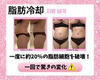 リハーツ(RE;heartz)