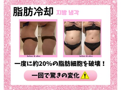 リハーツ(RE;heartz)の写真