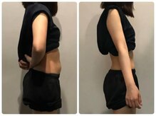 ストルツ(STOLZ)/約３ヶ月でこの変化！