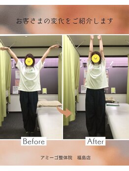 アミーゴ整体院/ビフォーアフター
