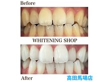 ホワイトニング専門店/ホワイトニング/ホワイトニングサロン