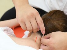 ほねつぎ ふじみ野はりきゅう接骨院