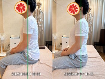 グレフル鍼灸接骨院 整体院 心斎橋/