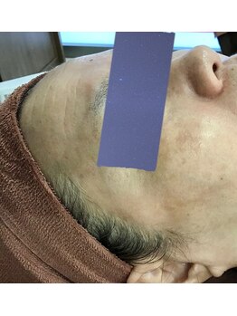 エスティフル 狭山店(ESTIFUL)/After/フェイシャル/マッサージ