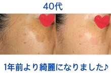 アイリスエステサロン 小禄店