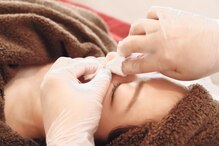 オゾンレメディ(O3remedy)