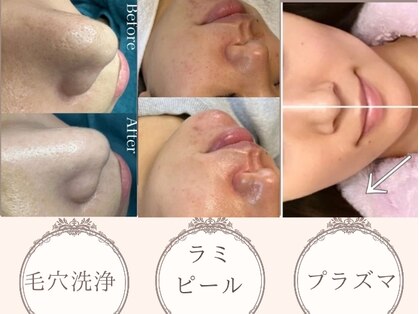 ビオエル 名古屋(BIOEL)の写真