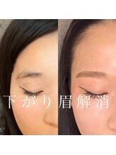 エリーゼ(Elise)/