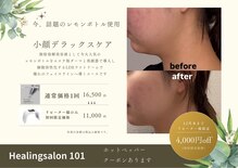 ヒーリングサロン イチマルイチ(101)