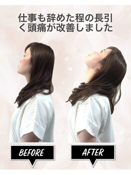 ニコ(nico)の写真/なぜ？10年来の頭痛から解放されたのか。経験豊富な専門家が「オーダーメイド施術」で辛い悩みを根本解消！