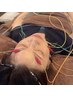 むくみ│食いしばり│眼精疲労ケア│電気を流す美容鍼 60分