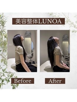 ルノア 渋谷院(LUNOA)の写真/体験60分￥3300。美容整体を極めたプロが、歪みを根本から整える独自の技術。［渋谷/美容整体/整体/肩こり］