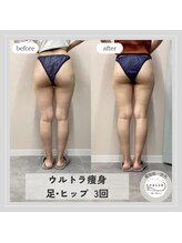 カラー(CALLA)/ウルトラ痩身☆足/ヒップ！