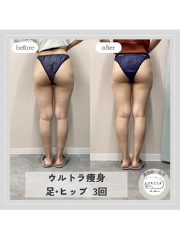 カラー(CALLA)/ウルトラ痩身☆足/ヒップ！