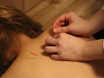 オータム(Autumn)/鍼