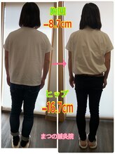 まつの鍼灸院/背中やお尻もスッキリ