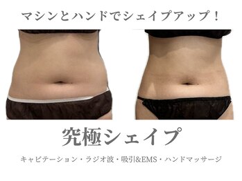 エクラ イオンモール徳島店(ECLAT)/究極シェイプ