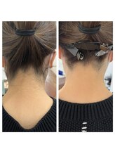 ビークラン(BecraN)/えりあし脱毛！