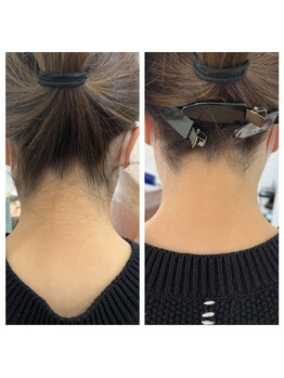 ビークラン(BecraN)/えりあし脱毛！